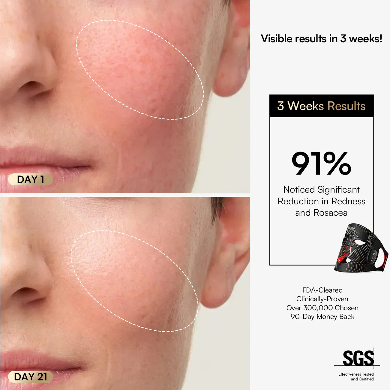 INIA  Wireless Red Light Therapy Mask