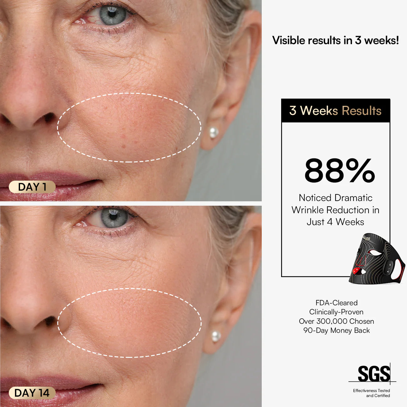 INIA  Wireless Red Light Therapy Mask
