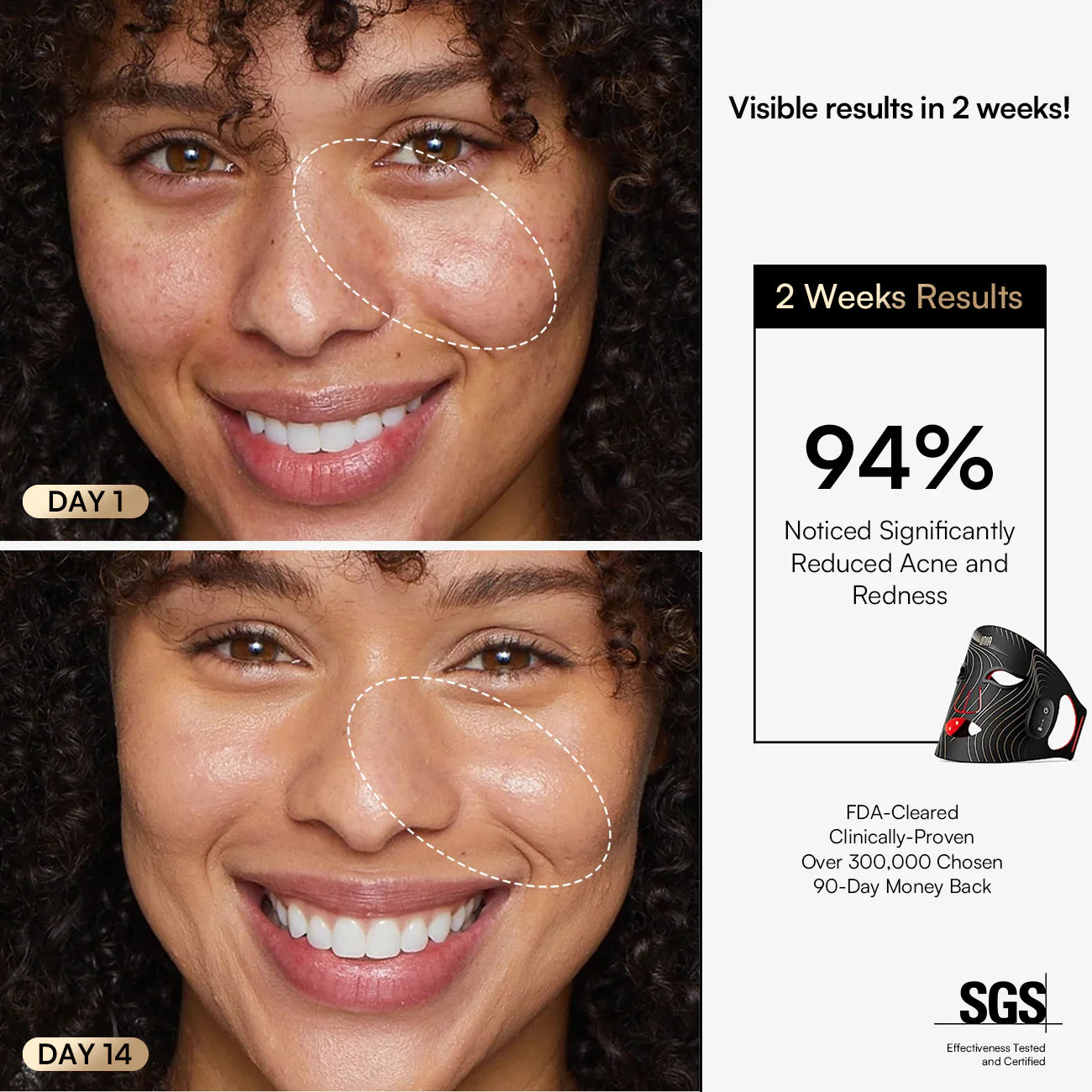 INIA  Wireless Red Light Therapy Mask